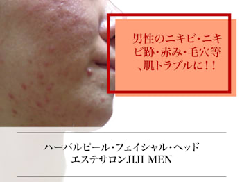 ハーバルピール・フェイシャル/ヘッド専門 エステティックサロンJ IJ I M E Nの店内