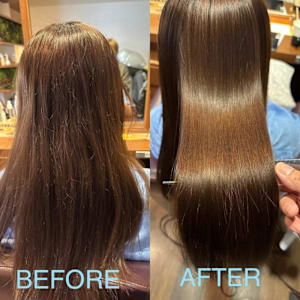 矯正ビフォーアフター