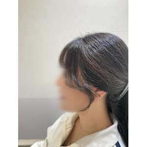 韓国風顔周り☆ SHIZUKU