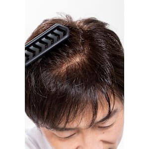 かつらセカンドオピニオン相談