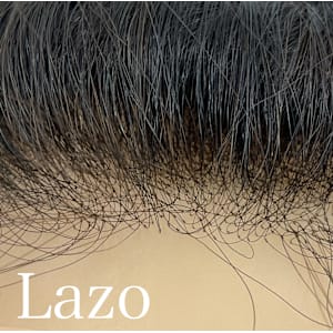 かつらセカンドオピニオン相談