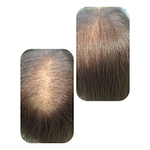 話題のトキカタ♪頭頂部編 - Hair & Spa y‐Forme Ginza【ヘアアンドスパユーフォルムギンザ】掲載中