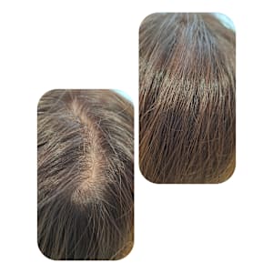 話題のトキカタ♪頭頂部編 - Hair & Spa y‐Forme Ginza【ヘアアンドスパユーフォルムギンザ】掲載中