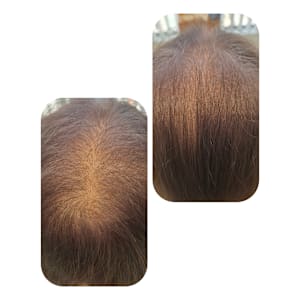 話題のトキカタ♪頭頂部編 - Hair & Spa y‐Forme Ginza【ヘアアンドスパユーフォルムギンザ】掲載中