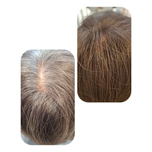 話題のトキカタ♪頭頂部編 - Hair & Spa y‐Forme Ginza【ヘアアンドスパユーフォルムギンザ】掲載中