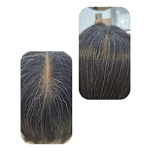 話題のトキカタ♪頭頂部編 - Hair & Spa y‐Forme Ginza【ヘアアンドスパユーフォルムギンザ】掲載中