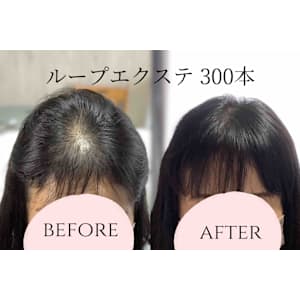 ループエクステ