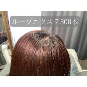 ループエクステ300本（beforeあり）