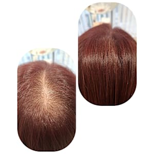 話題のトキカタ♪頭頂部編 - Hair & Spa y‐Forme Ginza【ヘアアンドスパユーフォルムギンザ】掲載中