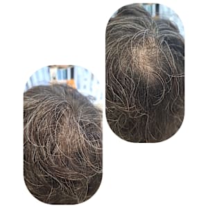 話題のトキカタ♪頭頂部編 - Hair & Spa y‐Forme Ginza【ヘアアンドスパユーフォルムギンザ】掲載中