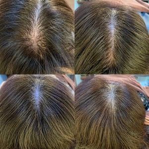 ニコヘアーオリジナル育毛メニュー