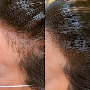 ニコヘアーオリジナル育毛メニュー