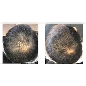 ニコヘアーオリジナル育毛メニュー