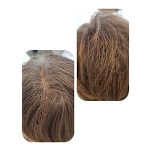 話題のトキカタ♪頭頂部編 - Hair & Spa y‐Forme Ginza【ヘアアンドスパユーフォルムギンザ】掲載中