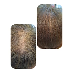 話題のトキカタ♪頭頂部編 - Hair & Spa y‐Forme Ginza【ヘアアンドスパユーフォルムギンザ】掲載中