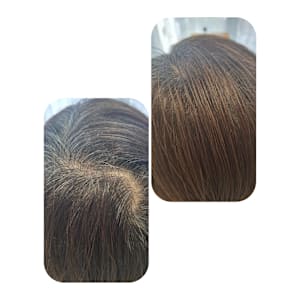 話題のトキカタ♪頭頂部編 - Hair & Spa y‐Forme Ginza【ヘアアンドスパユーフォルムギンザ】掲載中