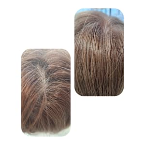 話題のトキカタ♪頭頂部編 - Hair & Spa y‐Forme Ginza【ヘアアンドスパユーフォルムギンザ】掲載中