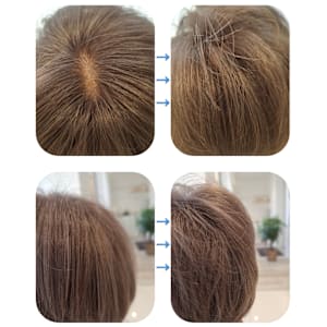 話題のトキカタ♪頭頂部編 - Hair & Spa y‐Forme Ginza【ヘアアンドスパユーフォルムギンザ】掲載中