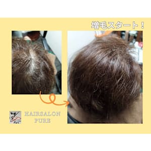 大人のエクステ、ボリュームアップ分け目や渦気にしない！ - Hair Salon Pure【ヘアーサロンピュア】掲載中