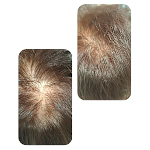 話題のトキカタ♪頭頂部編 - Hair & Spa y‐Forme Ginza【ヘアアンドスパユーフォルムギンザ】掲載中