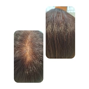 話題のトキカタ♪頭頂部編 - Hair & Spa y‐Forme Ginza【ヘアアンドスパユーフォルムギンザ】掲載中