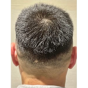 スキンフェード