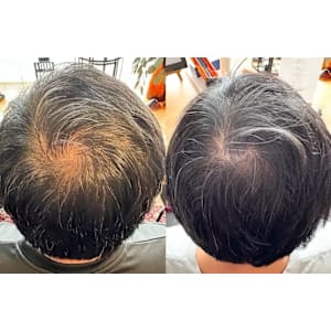 解頭リリース【スペシャル】（シャンプー・ブロー付）