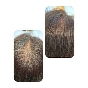 話題のトキカタ♪頭頂部編 - Hair & Spa y‐Forme Ginza【ヘアアンドスパユーフォルムギンザ】掲載中