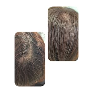 話題のトキカタ♪頭頂部編 - Hair & Spa y‐Forme Ginza【ヘアアンドスパユーフォルムギンザ】掲載中