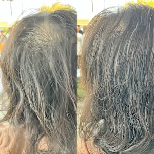 ハリコシアップ