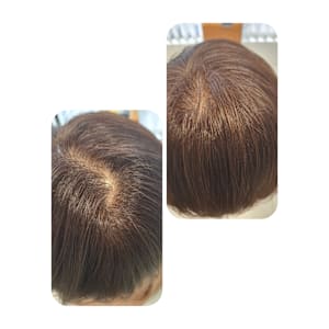 話題のトキカタ♪頭頂部編 - Hair & Spa y‐Forme Ginza【ヘアアンドスパユーフォルムギンザ】掲載中