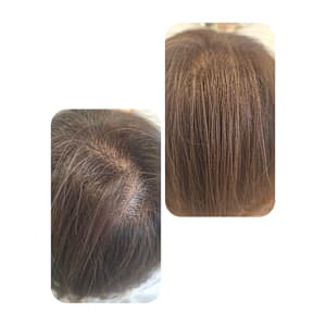 話題のトキカタ♪頭頂部編 - Hair & Spa y‐Forme Ginza【ヘアアンドスパユーフォルムギンザ】掲載中