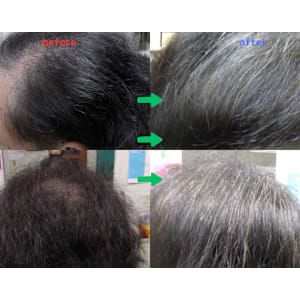 解頭リリース《ベーシック》（シャンプー・ブロー付）