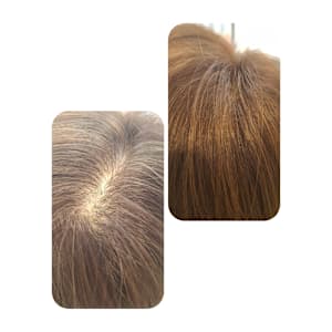 話題のトキカタ♪頭頂部編 - Hair & Spa y‐Forme Ginza【ヘアアンドスパユーフォルムギンザ】掲載中