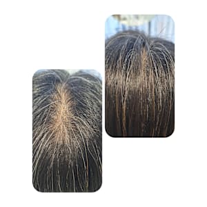 話題のトキカタ♪頭頂部編 - Hair & Spa y‐Forme Ginza【ヘアアンドスパユーフォルムギンザ】掲載中