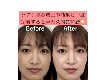 隆鼻矯正専門店 Raplit 福岡博多店(福岡県福岡市博多区)