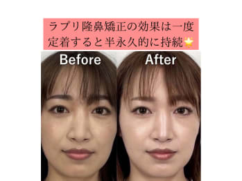 隆鼻矯正専門店 Raplit 福岡博多店(福岡県福岡市博多区)