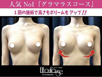 【バスト＆ヒップ専門店】エルフラージュ銀座店(東京都東京都中央区)