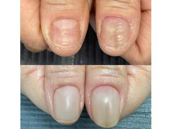 Nail Care Salon N(広島県広島市安佐北区)