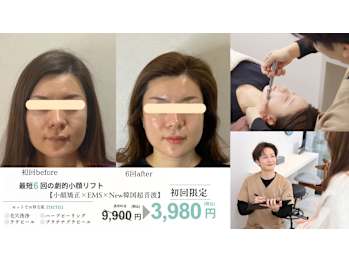 小顔・肌質改善サロンespoir ハーブピーリング/毛穴(大阪府大阪市中央区)