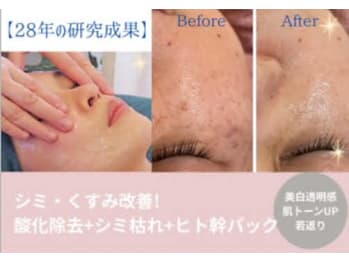トータル美還元サロン mindエステ北仙台店(宮城県仙台市青葉区)