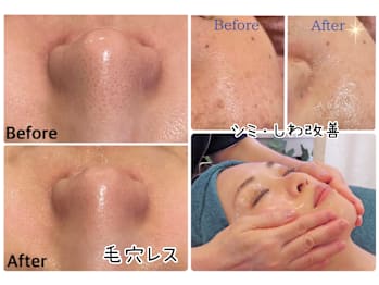 トータル美還元サロン mindエステプリミア虎ノ門店(東京都港区)