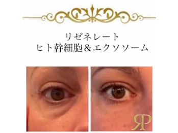 40歳からのエイジンサロン Raj Path ラージ パトゥ(大阪府茨木市)