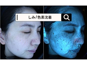 肌管理専門店BNurse用賀本店(東京都世田谷区)