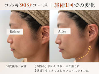 elma～小顔コルギ/肩こり/毛穴/リンパマッサージ/ヘッドスパ/肌管理～(大阪府大阪市中央区)