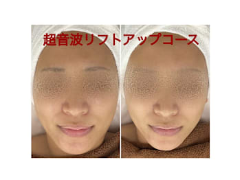 ちゅるん肌.COM 心斎橋店(大阪府大阪市中央区)