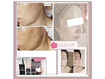 シェリング(千葉県千葉市中央区)