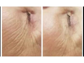 40歳からのエイジンサロン Raj Path ラージ パトゥ(大阪府茨木市)