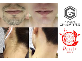 美肌脱毛＆トータルビューティー パールプラス 日田店(大分県日田市)