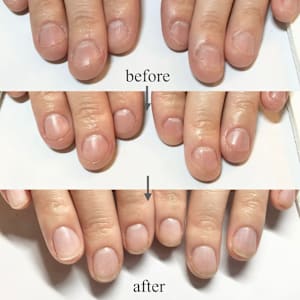 朝霞 志木 和光で口コミが多い 自爪 巻爪 深爪矯正が得意なネイル まつげサロンの検索 予約 楽天ビューティ